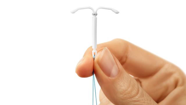 El Sistema IntraUterino