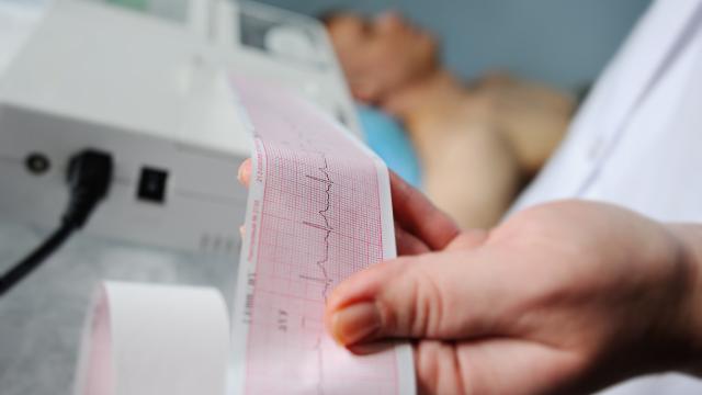 insuficiencia cardíaca crónica 