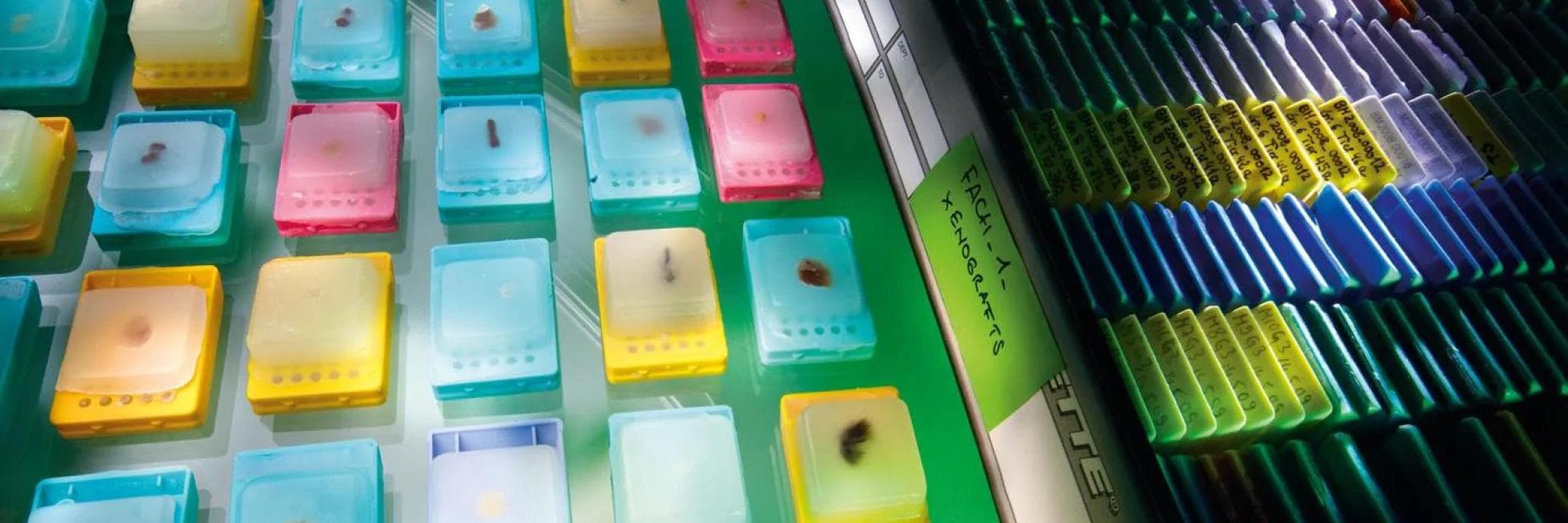 Una variedad de microplacas translúcidas y coloridas dispuestas sobre una superficie, algunas etiquetadas, junto a una bandeja de muestras bajo luz fluorescente.