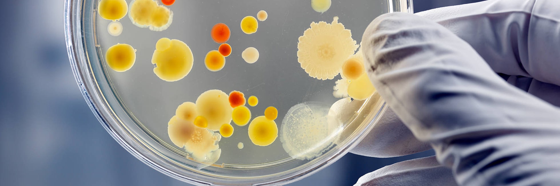 Una mano enguantada sostiene una placa de Petri que contiene varios cultivos bacterianos coloridos.